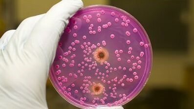 Patološki iscjedak kod muškaraca kad su uzbuđeni